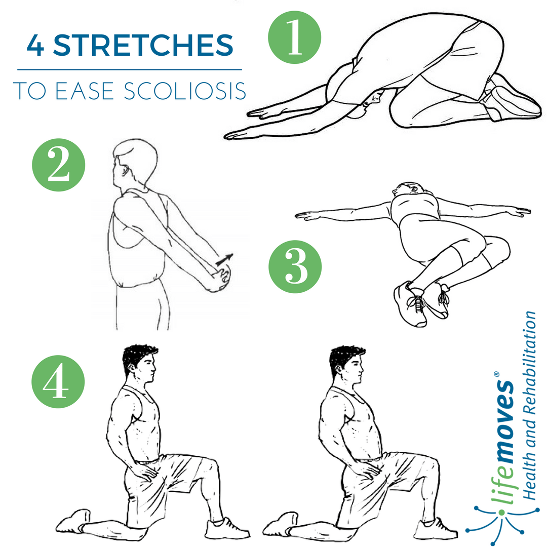 Scoliosis Exercises To Avoid